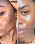 Model's skin after using The Inkey List The Moisture Boost Duo