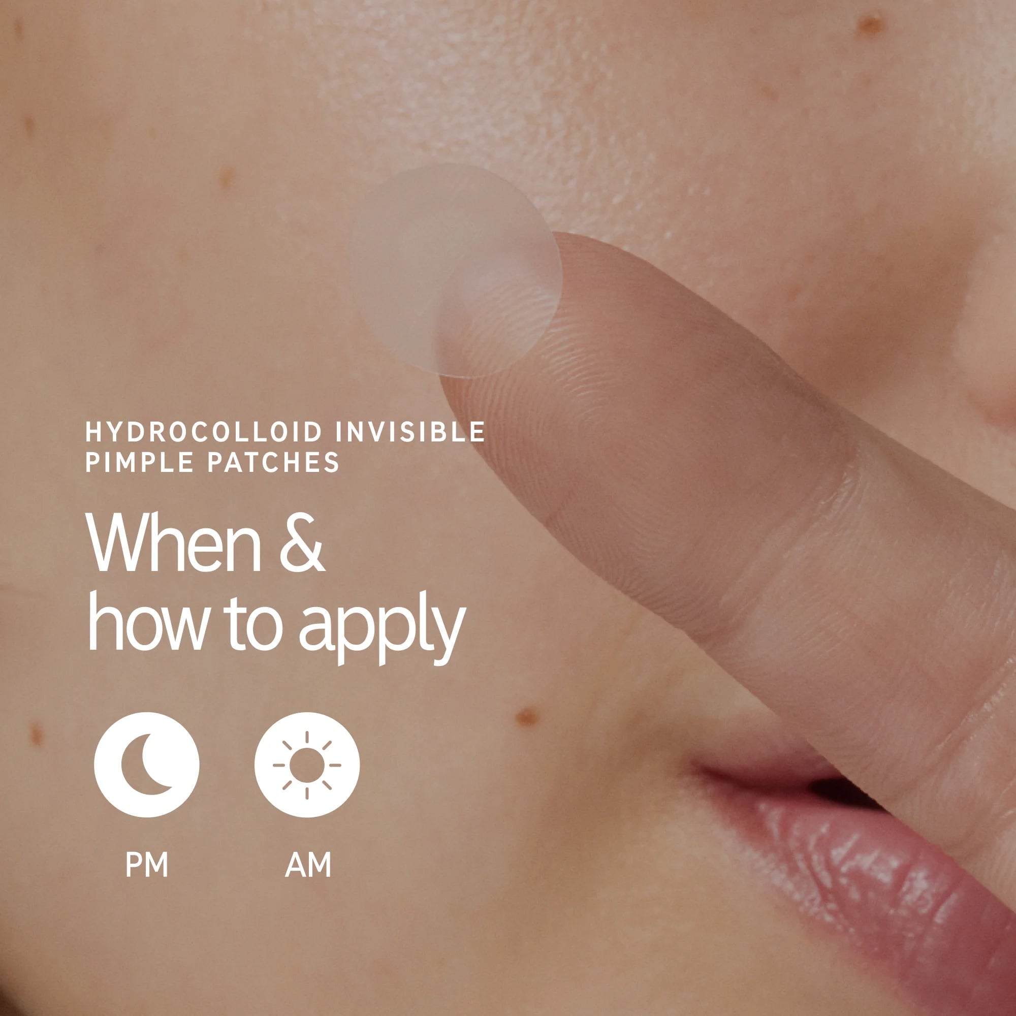 When to apply pimple patches included in The Inkey List The Spot On Duo