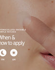 When to apply pimple patches included in The Inkey List The Spot On Duo