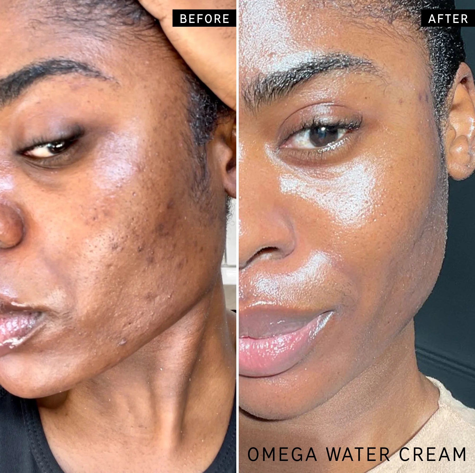Model before and after using Omega Water Cream