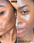 Model before and after using Omega Water Cream