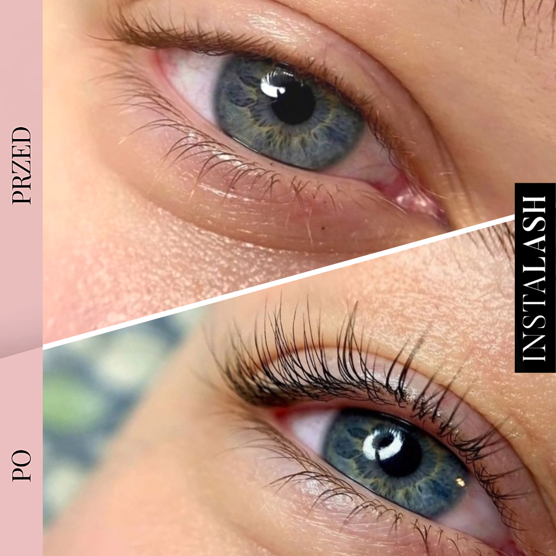 Before and after using Instalash LashBOOST SERUM – Lash & Brow Growth & Conditioning Serum