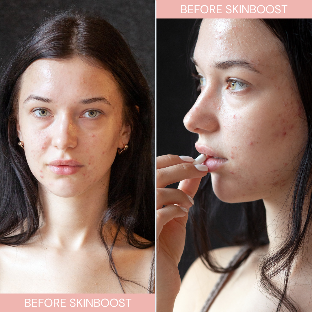 Before model used Instalash SkinBOOST – Dietary Supplement for Skin, Hair, Eyelashes &amp; Nails 60 capsules