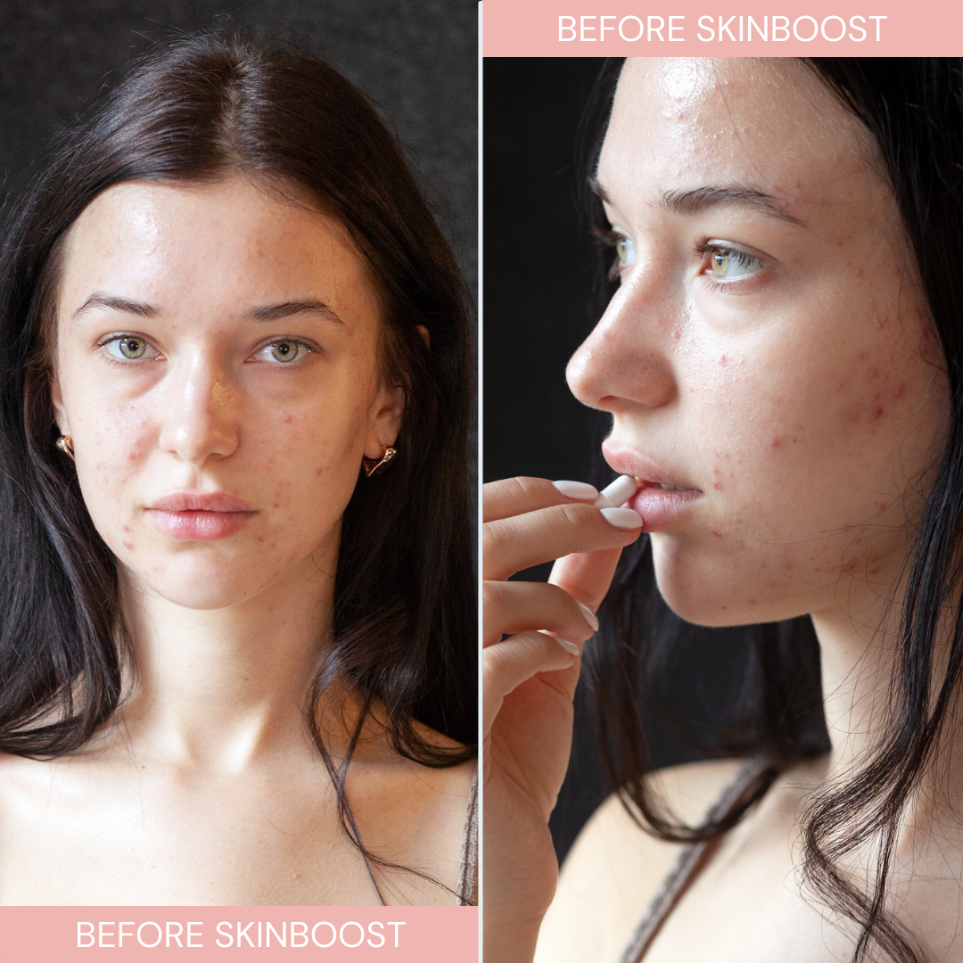 Before model used Instalash SkinBOOST – Dietary Supplement for Skin, Hair, Eyelashes & Nails 60 capsules