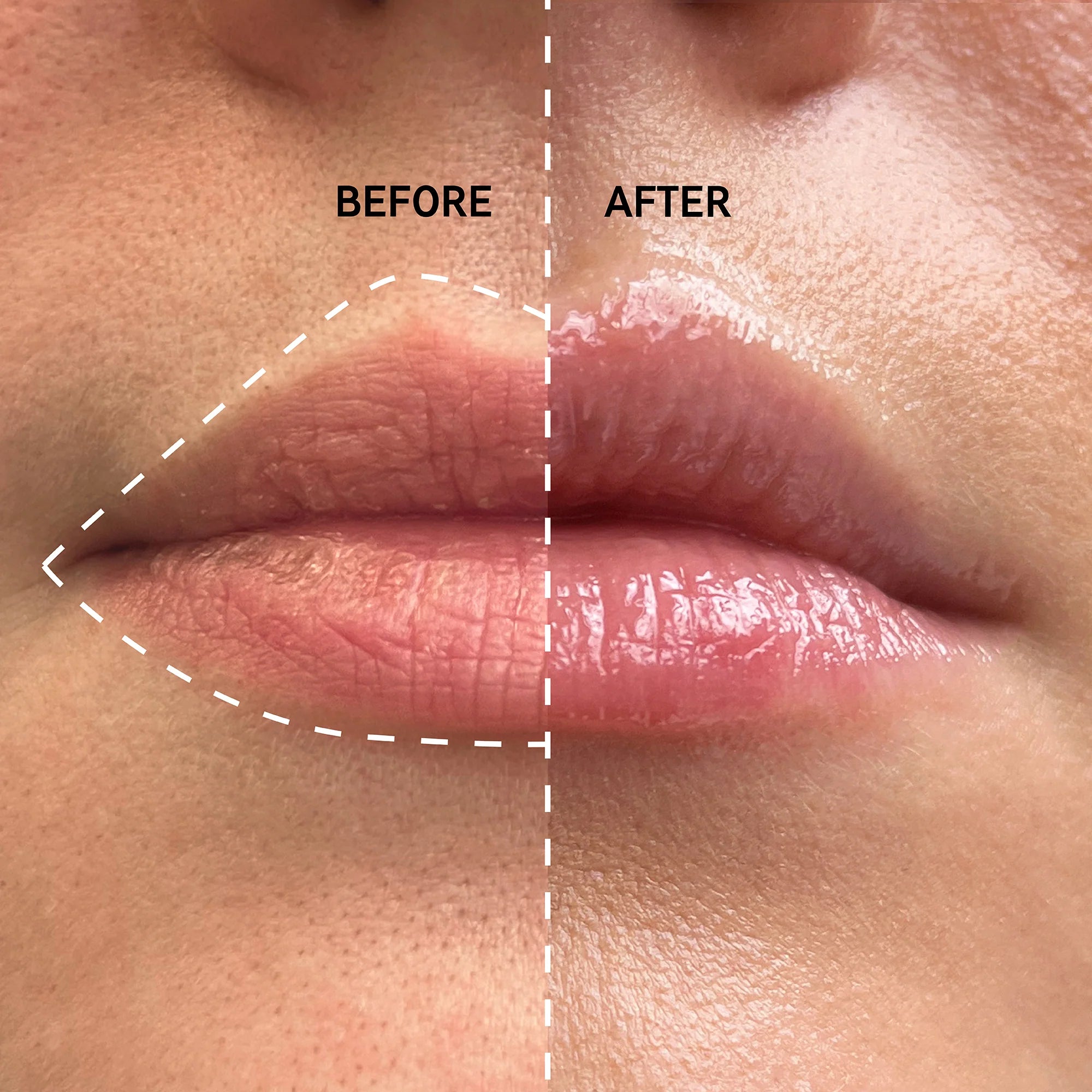 Increased lip volume after using The Inkey List Plump It Up