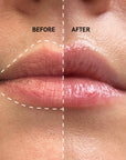 Increased lip volume after using The Inkey List Plump It Up