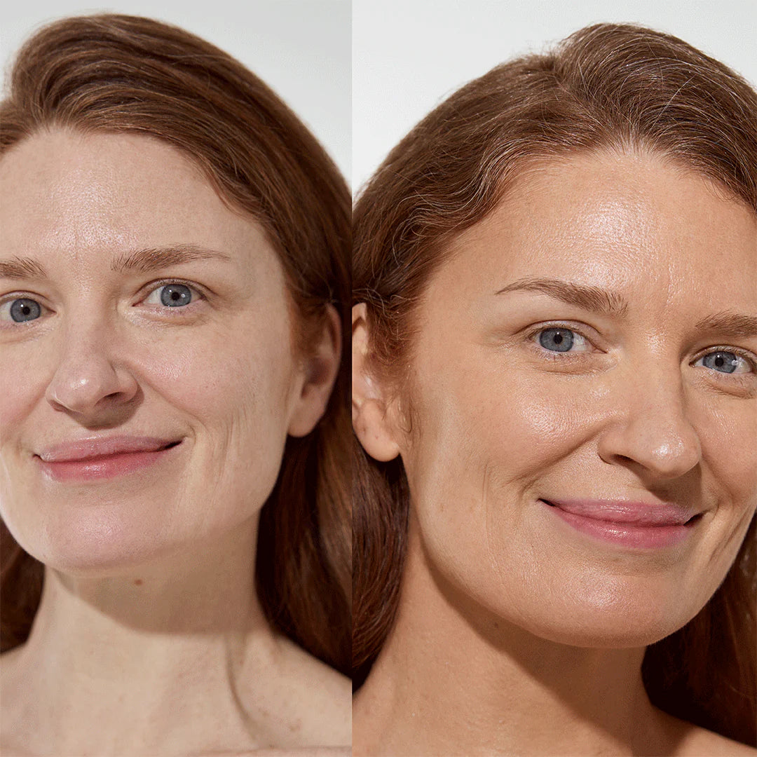 Red headed model, before and after using Vita Liberata The HA+ Face Tan With Niacinamide