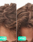 Before and after The Inkey List Gylcolic Scalp Treatment