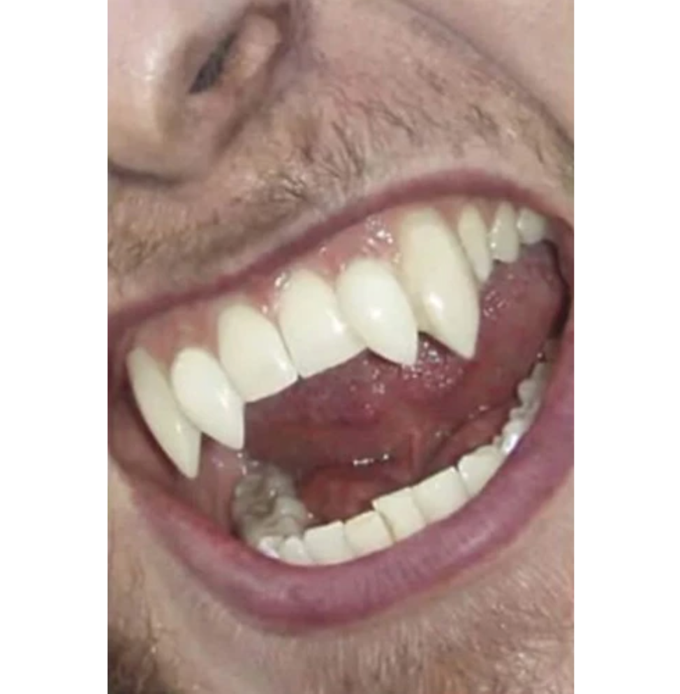 Model wearing Scarecrow Deluxe Werewolf Fangs
