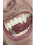 Model wearing Scarecrow Deluxe Werewolf Fangs