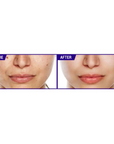 Before and after J Cat STAYSURANCE Water-Sealed / Zero-Smudge Concealer