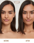 Before and after Vita Liberata Beauty Blur Face Medium