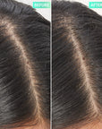 Before and after using The Inkey List Salicylic Acid Exfoliating Scalp Treatment 150ml