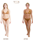 Before and after Vita Liberata Body Blur Body MakeUp - Medium